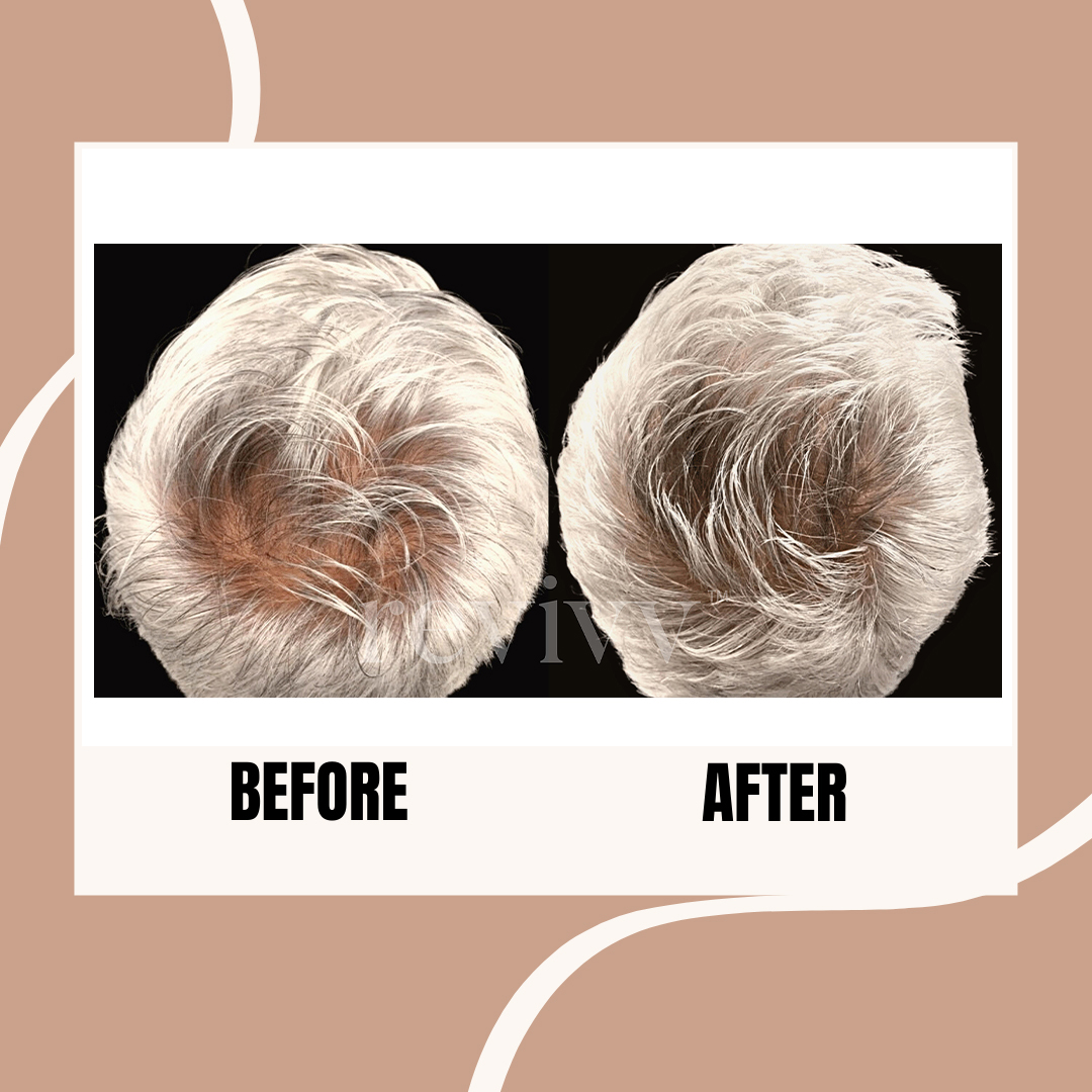 After using Revivv® for 8 months