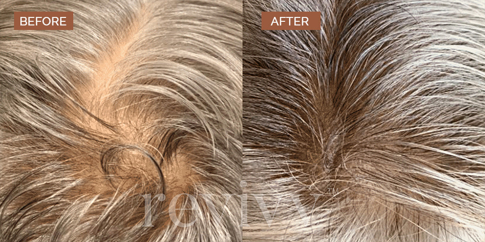 revivv for him before and after